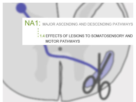 Effects of lesions image