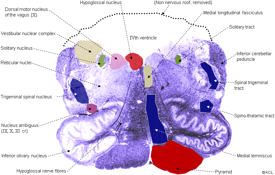 Section 5: Open medulla, level of inferior olive: all tracts and nuclei (advanced)