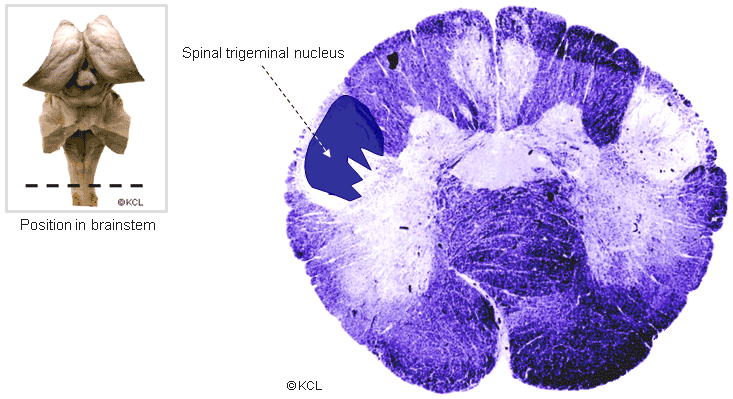 Section 3: Brainstem > level of pyramidal decussation