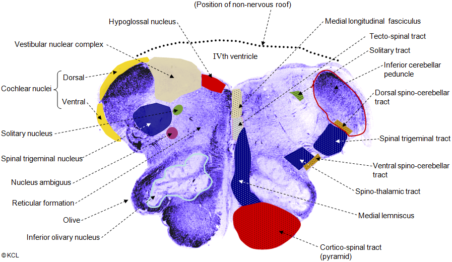 Section 6: open medulla 2 > all tracts and nuclei