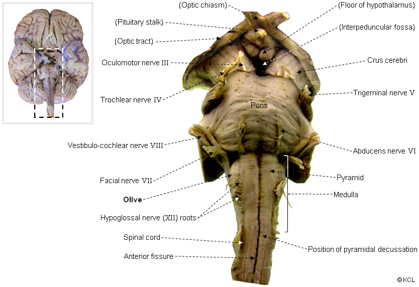 Spino-cerebellar pathway - inferior olive