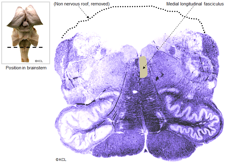 Medial longitudinal fasciculus