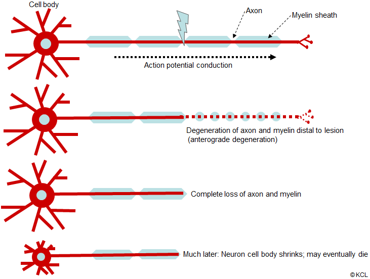 Effects of an axonal lesion in the central nervous system