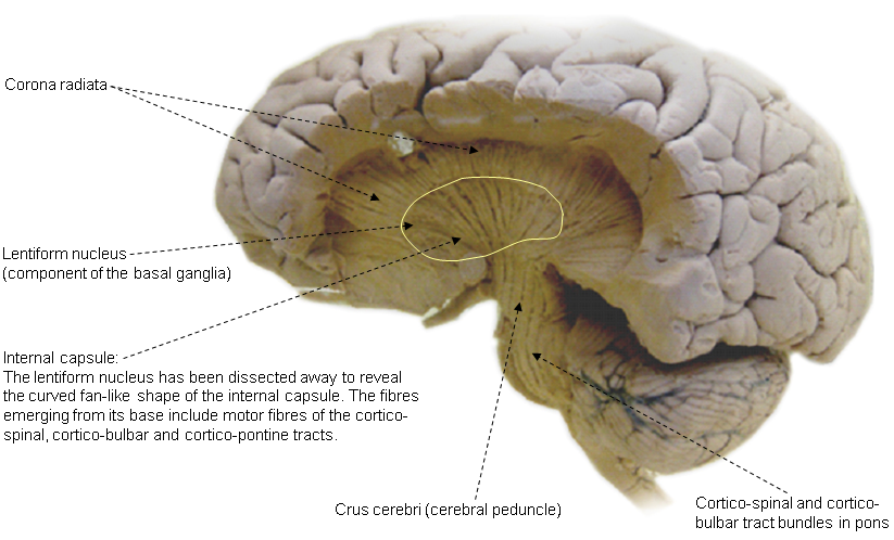 Internal capsule and related structures dissected from the lateral side