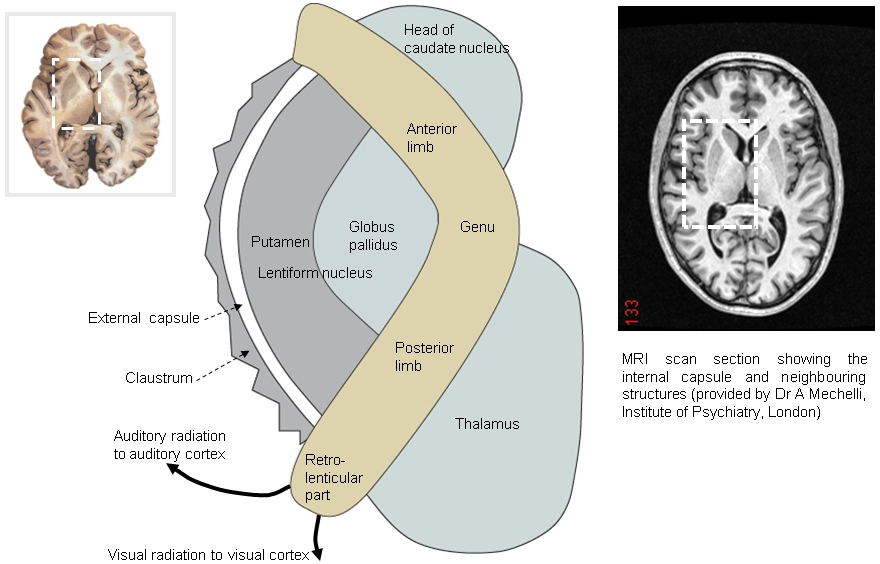 Internal capsule regions and related structures in horizontal section