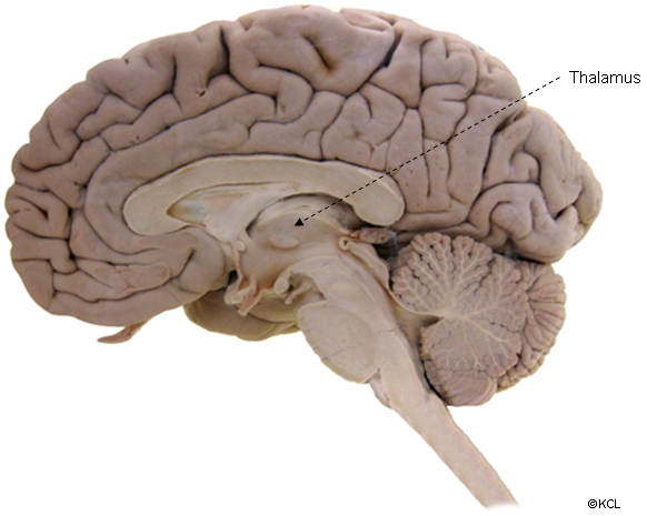 Thalamus - medial view in sagittal section