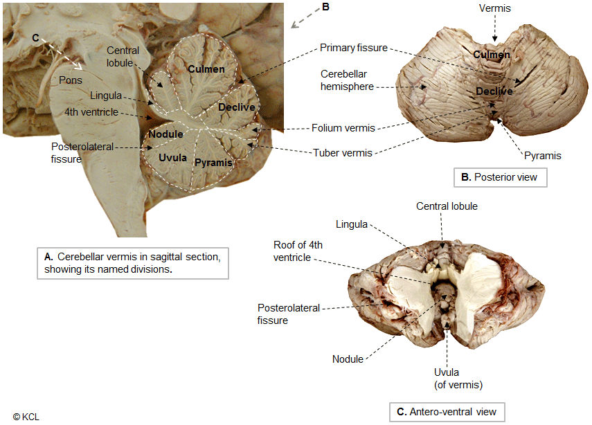 Divisions of the vermis - 3 different views