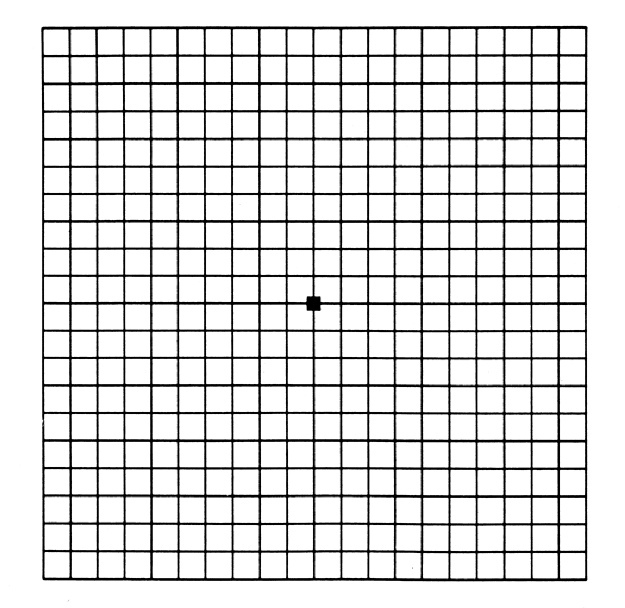 Amsler chart appearing as 'normal'