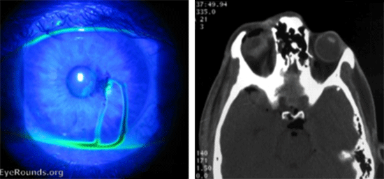 p-and-p-injury-2-no-source