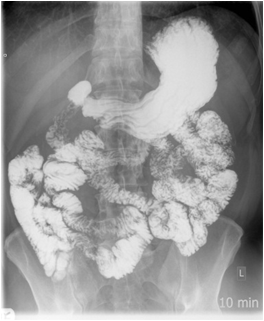 abdominal and pelvis ct