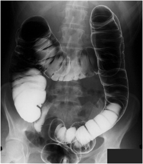 abdominal and pelvis ct