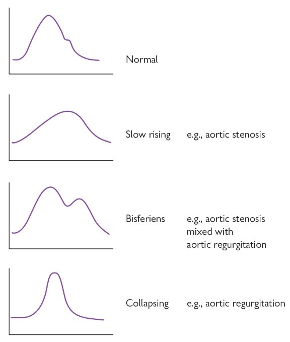 Pulse characters graphs