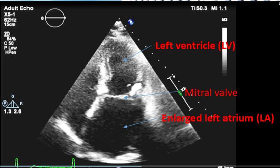 ECG image