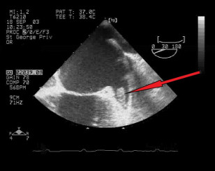 Cardiac image