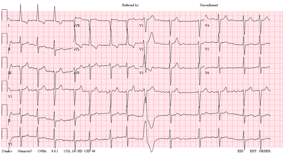 ECG image