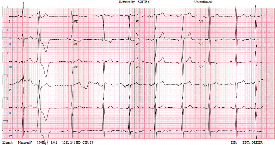 ECG image