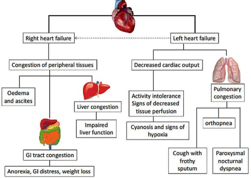 Heart Failure Signs