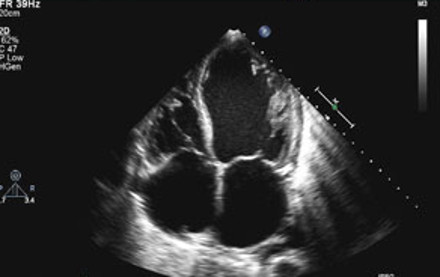 ECG image